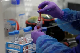 The disease was first detected in 1967 [File: Kirsty Wigglesworth/Pool via Reuters]